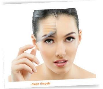 Mesolift de antirimpelbooster zonder pijn en zonder botox! Mesotherapie wordt vervangen door Mesolift de natuurlijke manier van anti-rimpelbestrijding