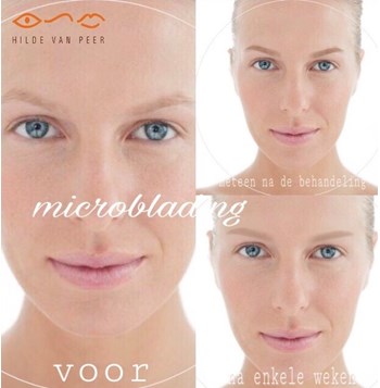 Microblading wenkbrauwen onmiddelijk natuurlijke haartjes Ook voor jonge vrouwen geeft microblading wenkbrauwen een dynamischere uitstraling