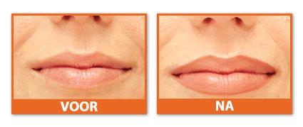 permanente make-up ingekleurde lippen permanente make-up lippen Hilde Van Peer